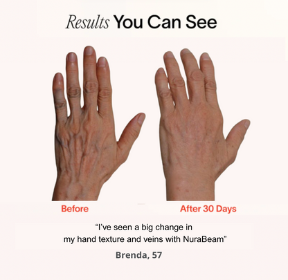 NuraRenewal™ Hand Glove